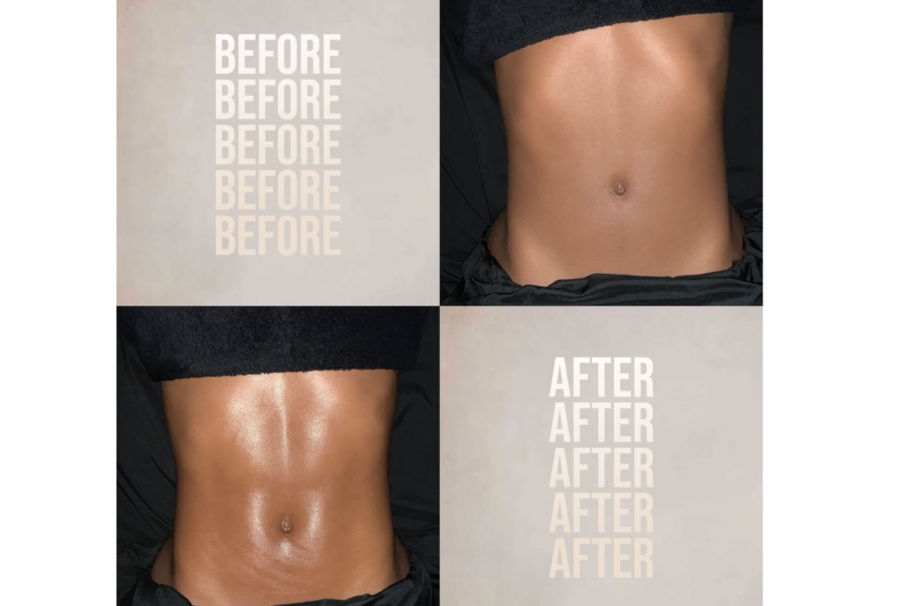 Before-and-after-1-20-26